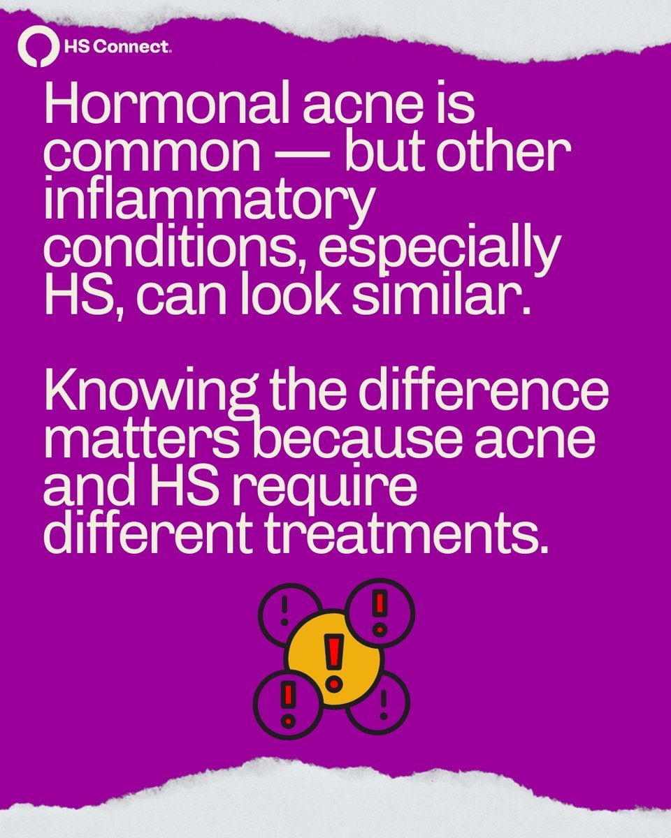HSConnectOrg's tweet image. Hormonal acne or HS? 🔎💜

They may look alike, but they’re not the same, and knowing the difference can make all the difference in getting the care you deserve.

#HidradenitisSuppurativa #HSCare #HSCommunity #ChronicIllness #HSAwareness