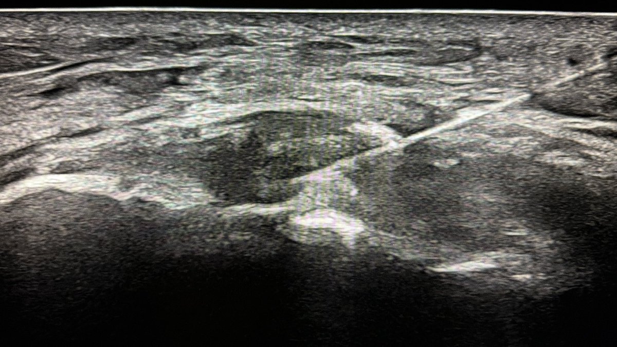 Dr Jörg Dünkel tweet media