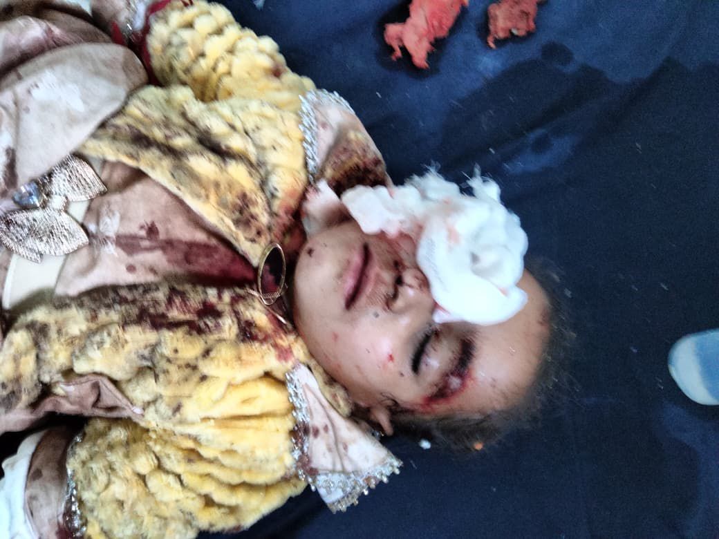 PakDefence_'s tweet photo. North Waziristan, Pakistan; 
The images of locals, including children, targeted in the suicide bombing by Talibans' backed TTP terrorists before Iftar are truly horrifying.
 Will you post about this ?@IHRF_English @doamuslims @muslimdaily_ @UNHumanRights @UNAMAnews https://t.co/npYKVCqBId