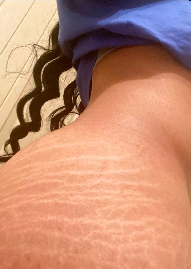 Lola girl 📸 tweet media