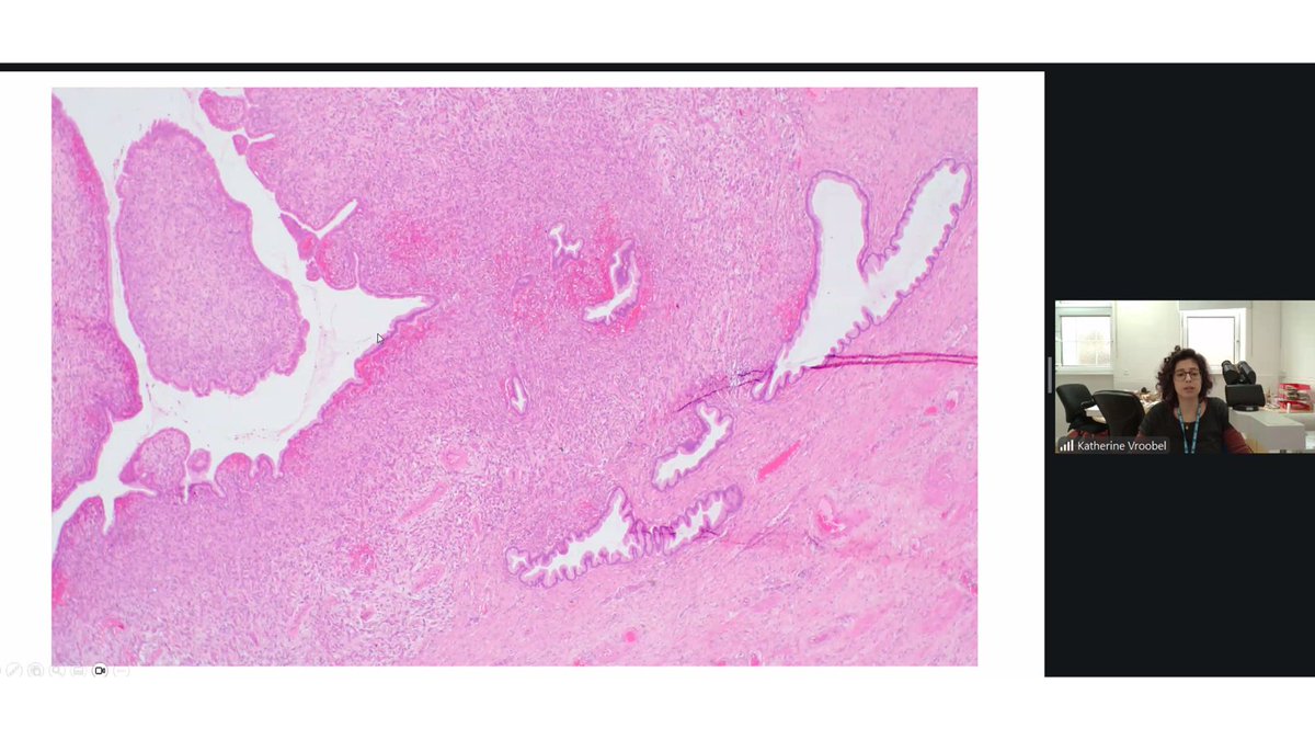 The British Assoc of Gynaecological Pathology tweet media