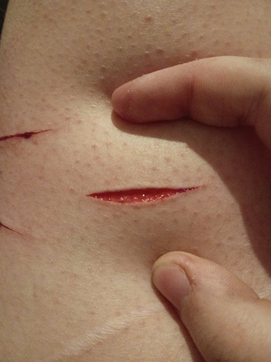 🍓sprout of shtwt🩸 tweet media