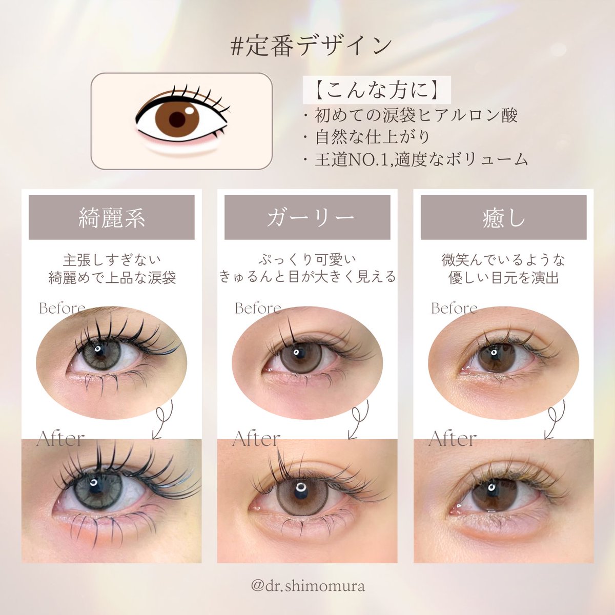dr_Shimomura_'s tweet photo. 涙袋ヒアルロン酸デザインまとめ✨

分かりやすくまとめたので、参考にしてください😌 https://t.co/q59EEmK5NR