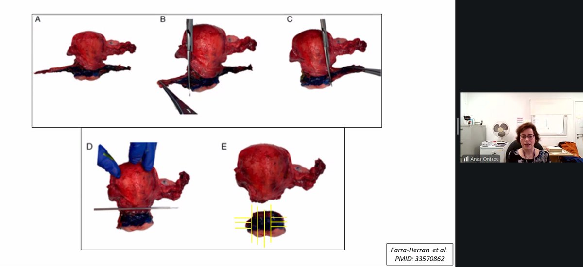 The British Assoc of Gynaecological Pathology tweet media