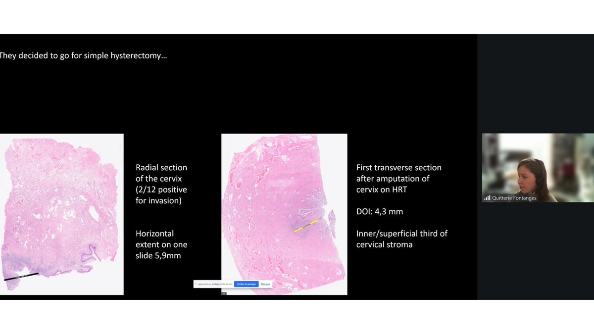 The British Assoc of Gynaecological Pathology tweet media