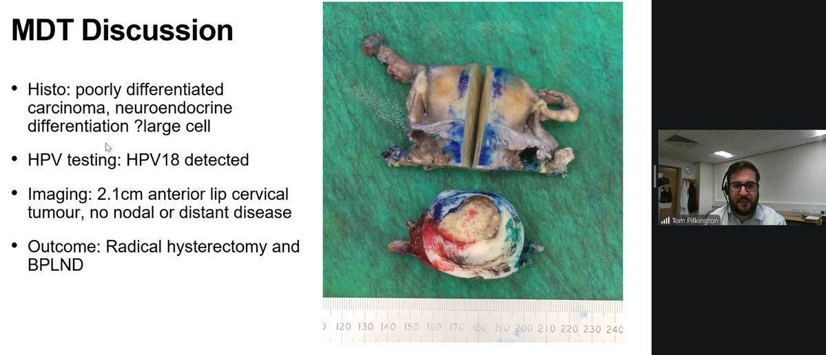 The British Assoc of Gynaecological Pathology tweet media