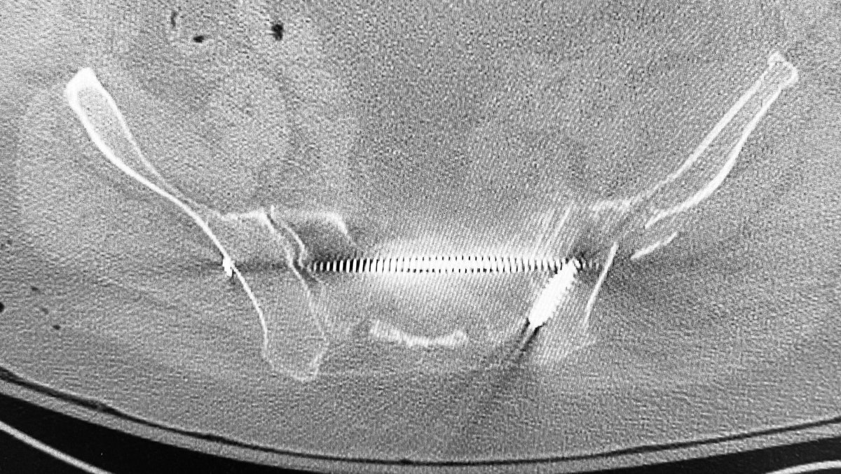 ML Chip Routt tweet media