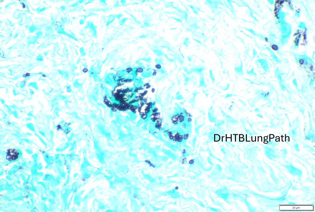 Humberto Trejo Bittar, MD, FCAP tweet media