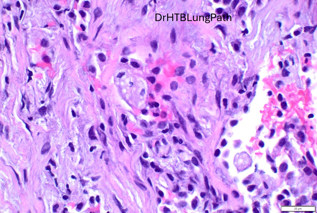 Humberto Trejo Bittar, MD, FCAP tweet media