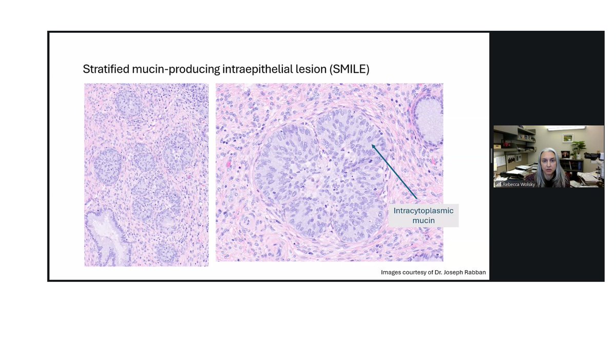 The British Assoc of Gynaecological Pathology tweet media