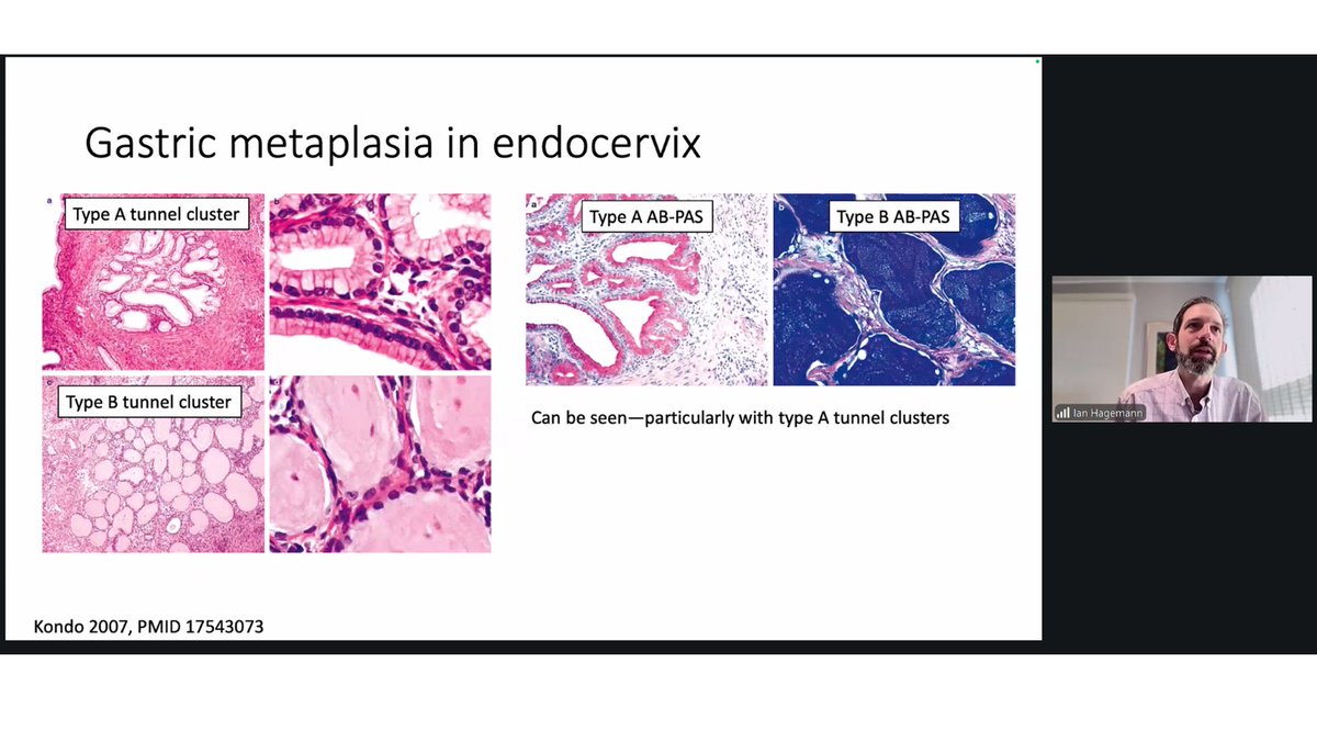 The British Assoc of Gynaecological Pathology tweet media