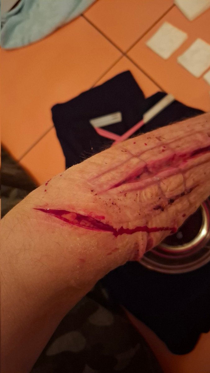 lei |-/ shedtwt ## sh relapse era tweet media