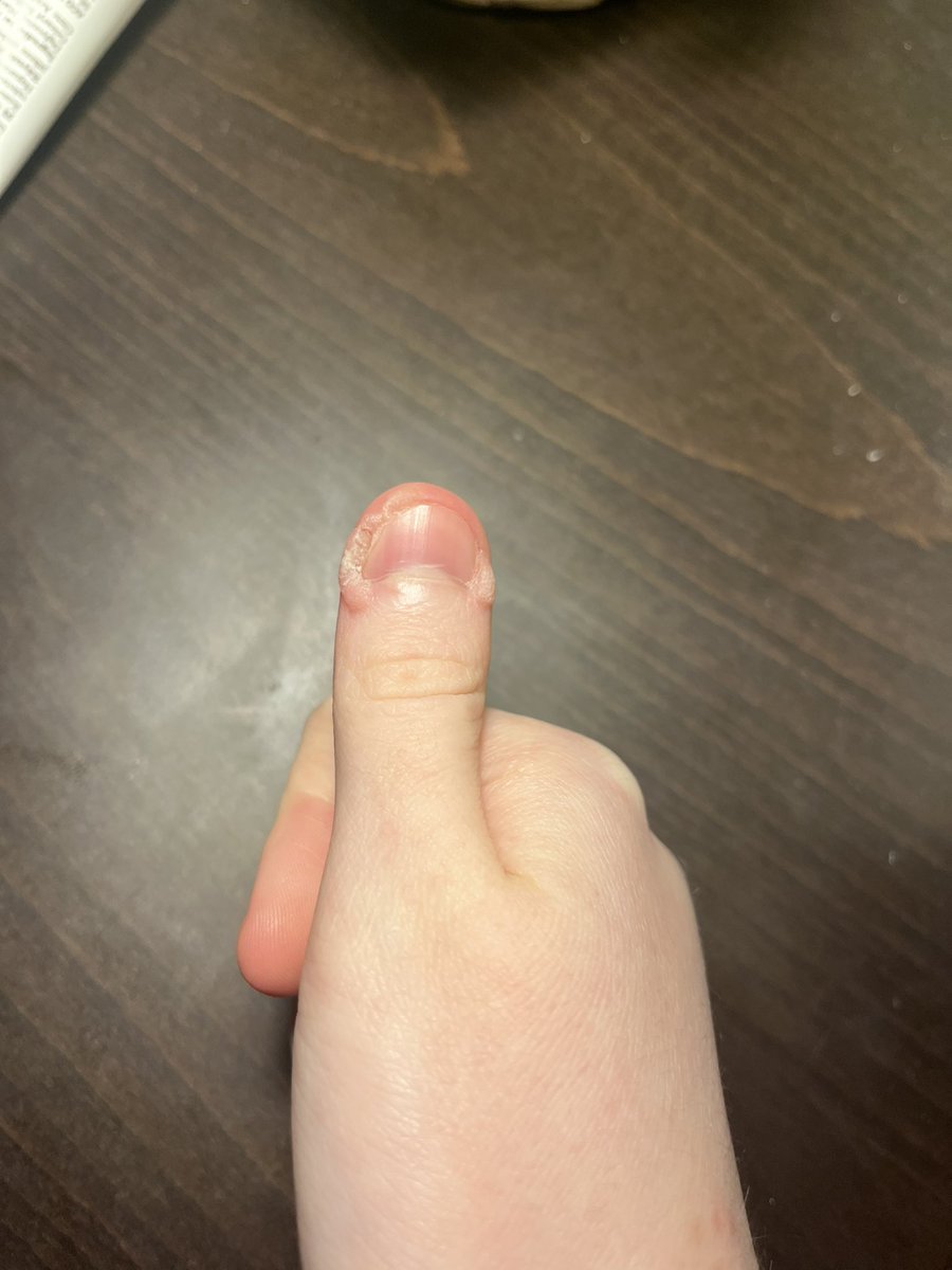 mini/Munken🦜 tweet media