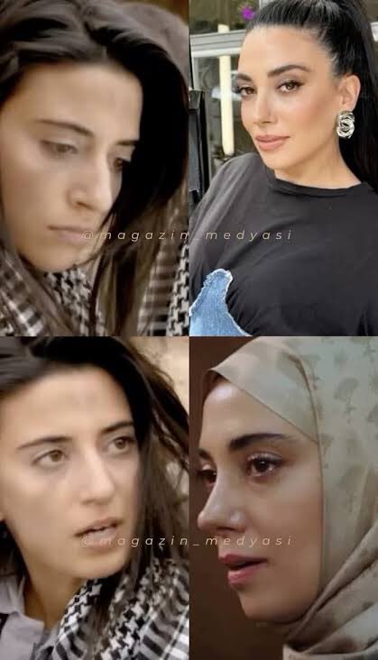 Nursema’nın burnu estetikmiş #kızılcıklerbeti