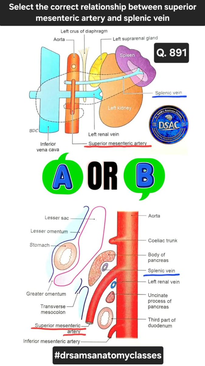 docazmi's tweet photo. Q. 891. Relationship between superior mesenteric artery and splenic vein. Select the correct image A or B?
#NEETPG https://t.co/9DiyCMqYNk