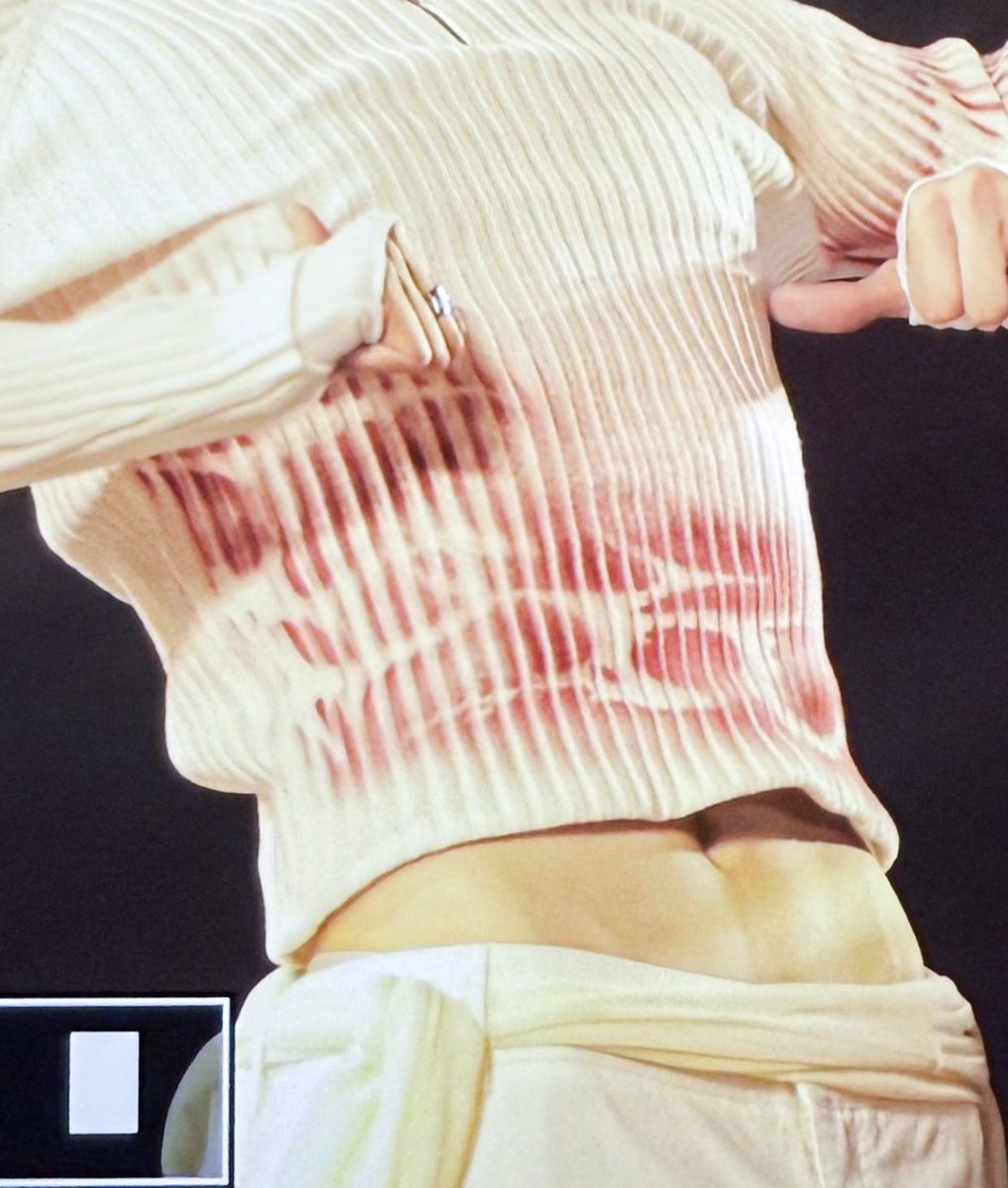 woosanger's tweet photo. who thought it was a good idea ???????????? put them on the line, i wanna speak https://t.co/fWfk3y4CXD