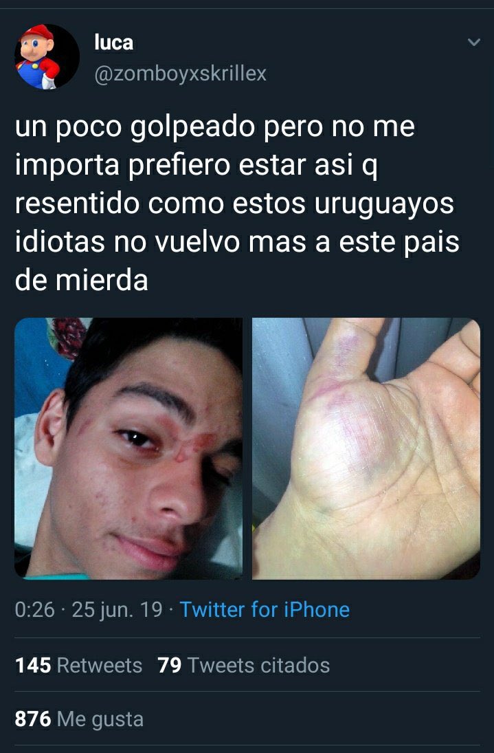 diego 🇳🇱🇺🇾 tweet media