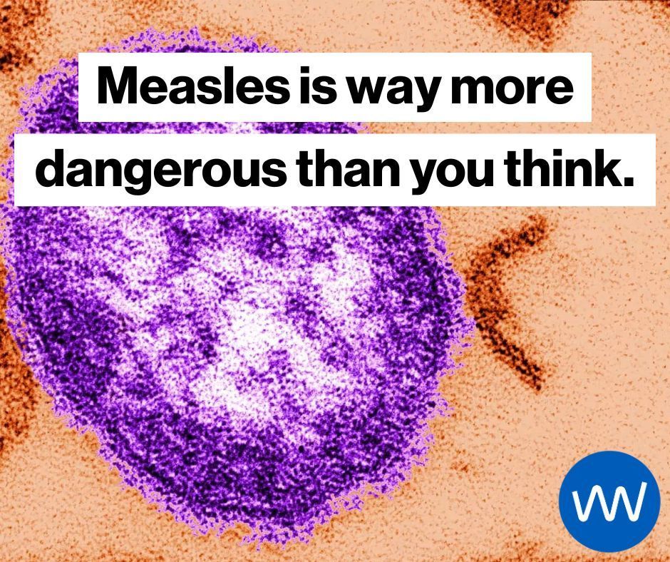 gavi's tweet photo. Measles is much more than just a harmless childhood rash. 

Cases are rising again, and the risks go far beyond what many people realise. 

Here are 7 things worth knowing about measles: https://t.co/uQvjB26rHf https://t.co/NyUtRZfYDT