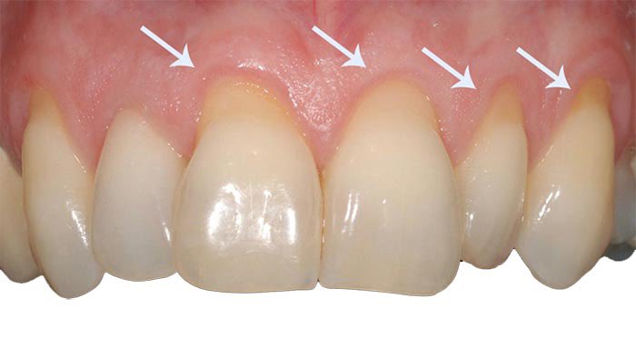 Little Paul tweet media