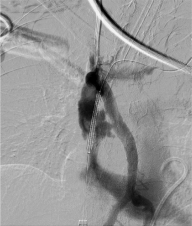 JVS - Venous and Lymphatic Disorders tweet media