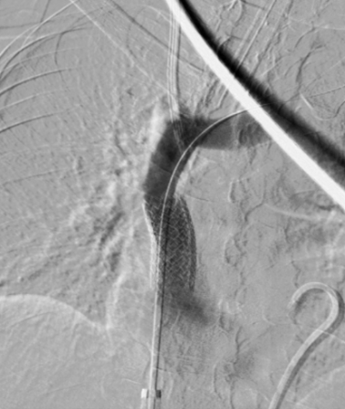 JVS - Venous and Lymphatic Disorders tweet media