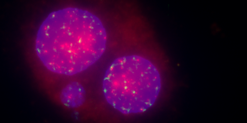 Xenometrix's tweet photo. Fast, Direct and Precise Detection of Clastogens and Aneugens: 
Rapid Micronucleus MoA 
Centromere Telomere

#Rapid #Micronucleus #ModeOfAction #Clastogenic #Aneugenic #Fast #Results #OECD #TG487 #TG473 #Reliable #GenotoxicityAssessment #ReadyToUseKit #NoLicenceFee https://t.co/lPTropsq34