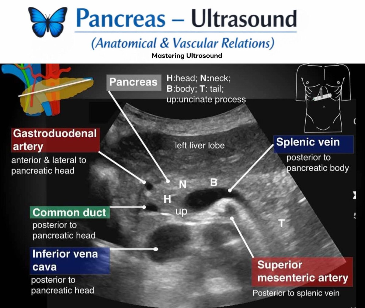 Abuhalima tweet media