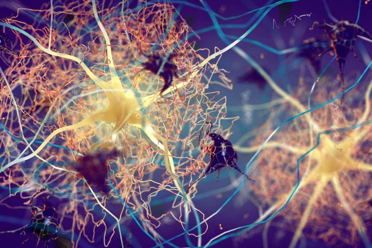 DiverseElders's tweet image. The #Alzheimer’s field is being turned on its head as mounting #evidence points to the #disease #beginning #outside the brain many years before symptoms start. This may mean we have to totally rethink how we approach preventing and treating the condition buff.ly/tkxyIt1