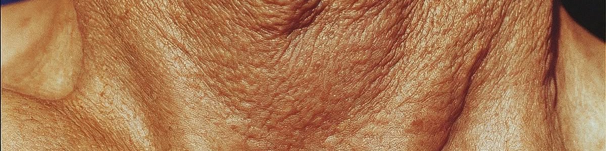 𝙷𝚈𝙿𝙴𝙾𝙽 tweet media