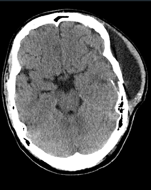 No Arm Whatley tweet media