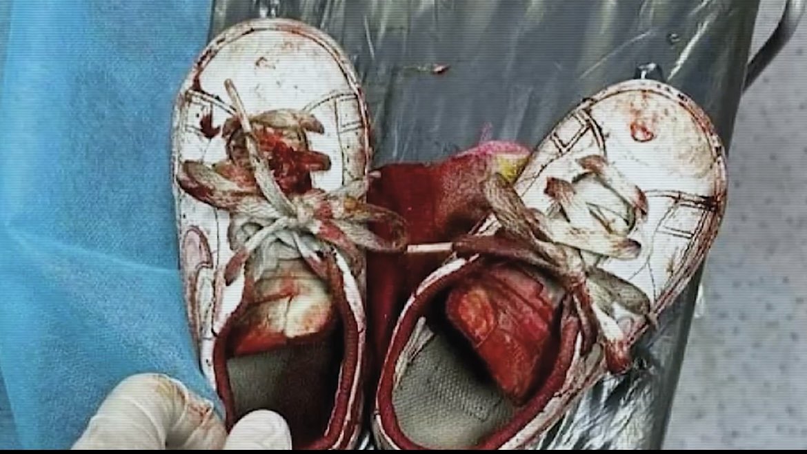 200 bin çocuk öldü Gazze’de  bir o kadar da kayıp çocuk var.. Kim İsrail’in yanında duruyorsa, bu kanlı ayakkabıları kim görmüyorsa zalimdir. Allah mazlumun ve mazlumu sevenin yanında durmayı nasip eylesin.