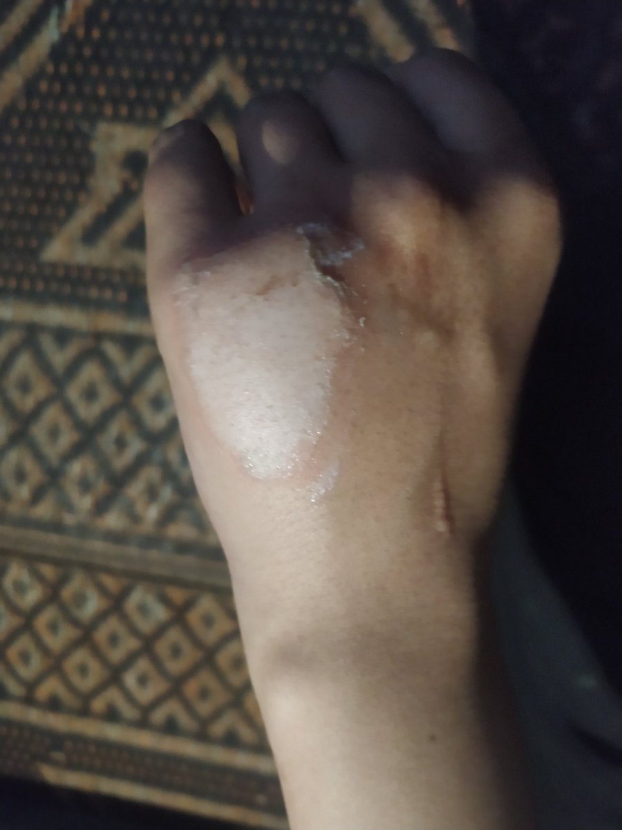 qusay | Gaza🇵🇸 tweet media