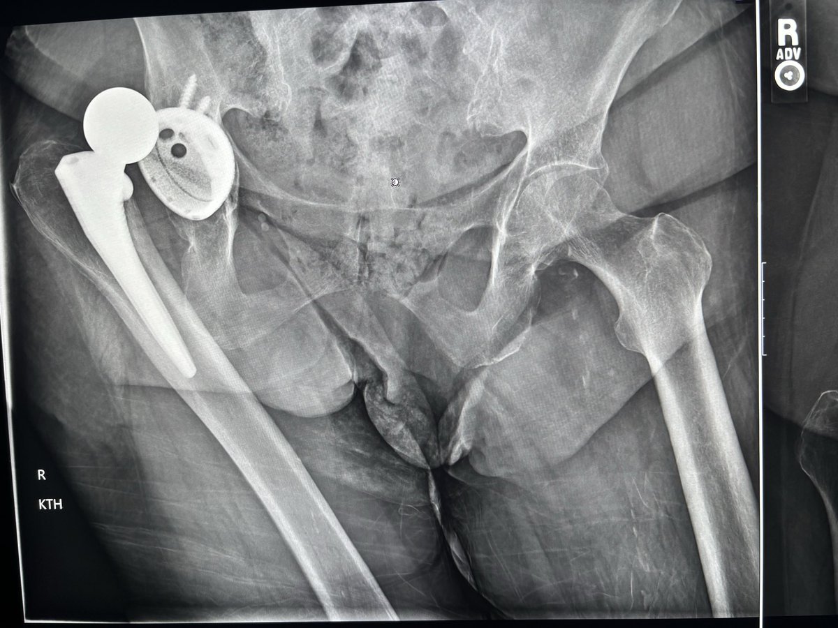 Doug Lake tweet media