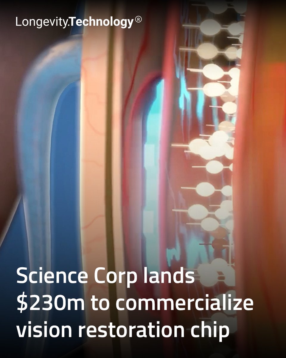 LongevityTech's tweet photo. Neurotech company aims to become first BCI developer with a commercial product to restore vision in patients with retinal disease.

https://t.co/o7tilP6Sxl

@ScienceCorp_ @maxhodak_  #longevity #neurotech #investment #BCI #AMD #visionloss https://t.co/5yWorw5Htn