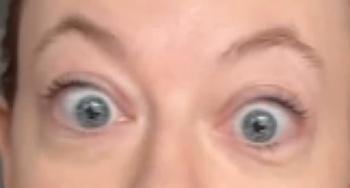 Mgoes (bio/acc 🤖💉) tweet media