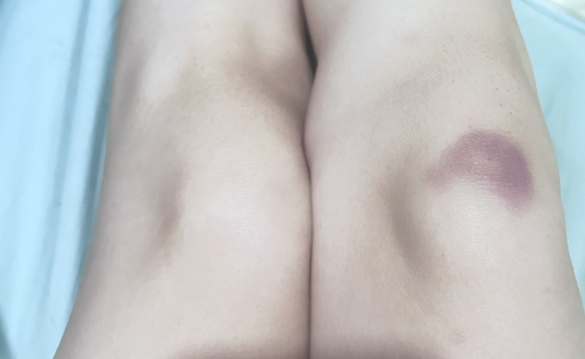 兔子是怎么叫的 tweet media