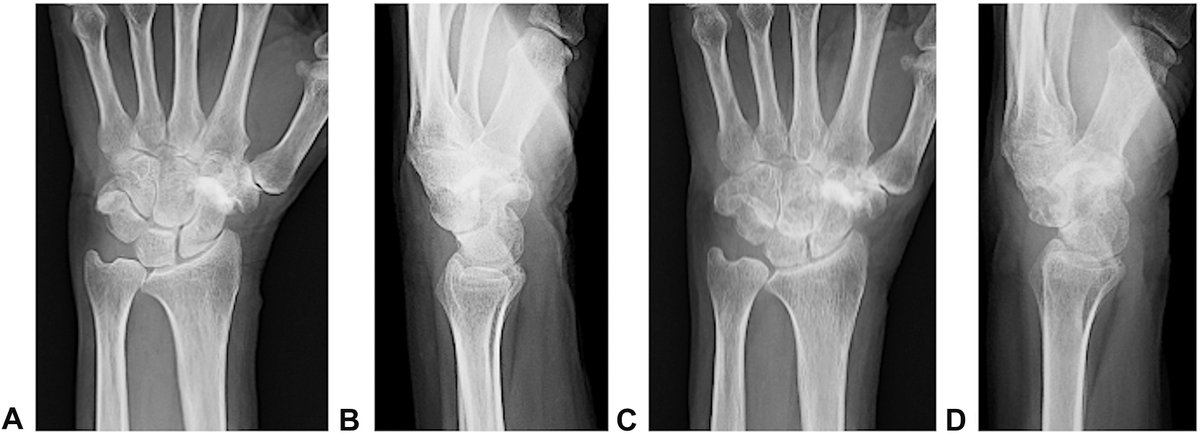 J Hand Surg Am- ASSH tweet media