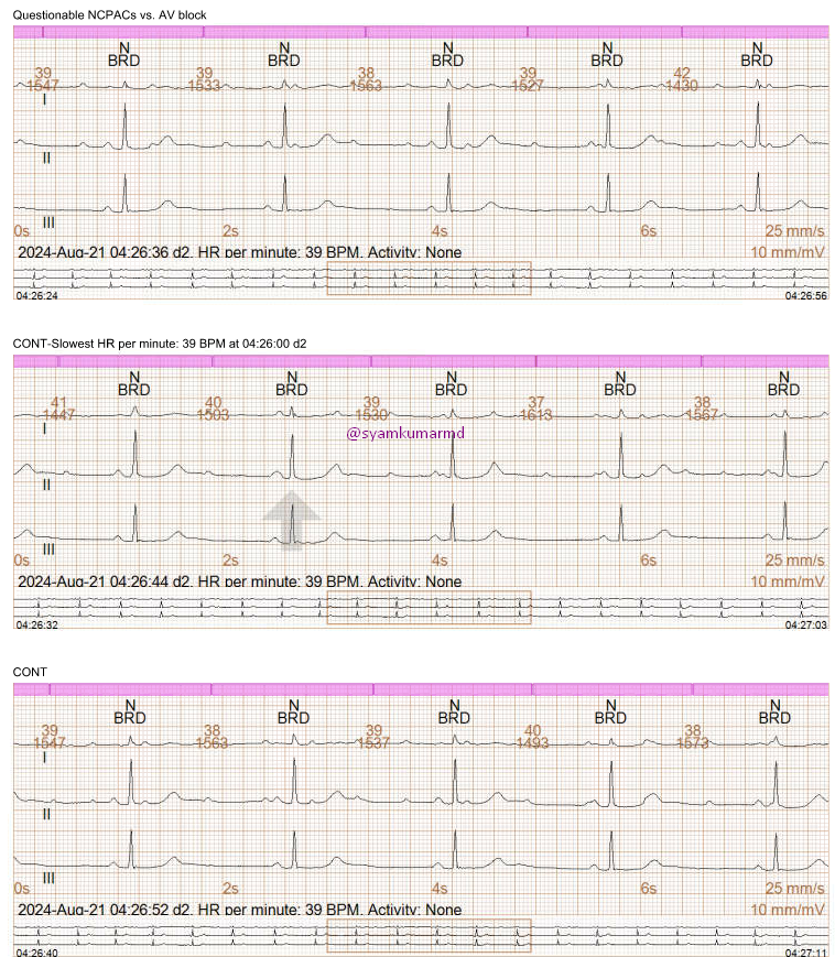 syamkumarmd's tweet image. How to best describe this? #EPeeps