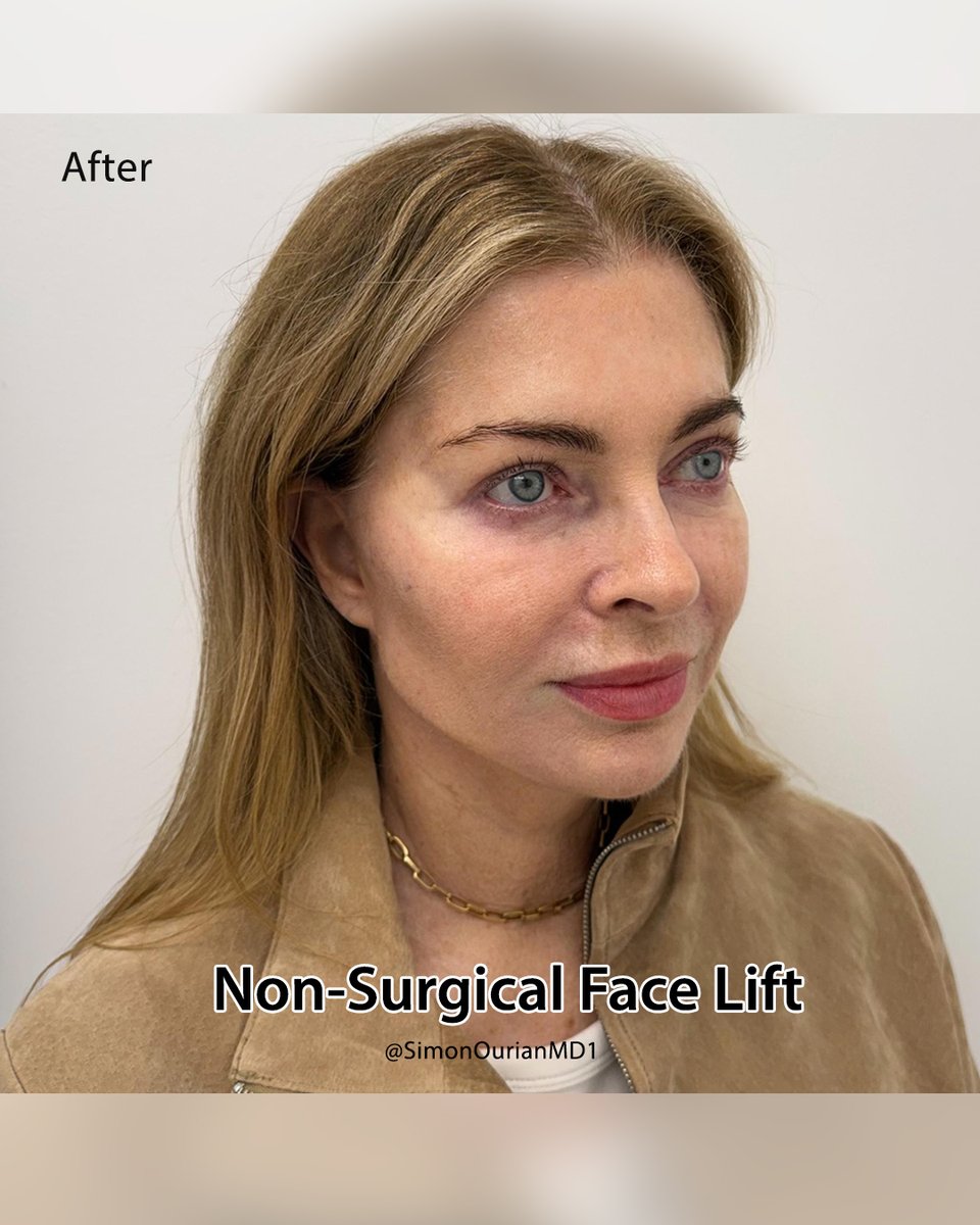 Dr. Simon Ourian - Epione tweet media