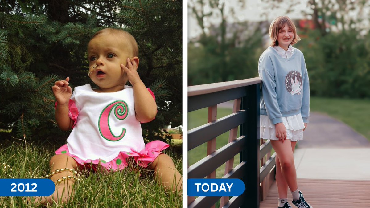 donatelifenw's tweet photo. At 14 mo/old, Claire received the call that changed everything, a donor liver had been found.

Today, Claire is 14 years old and thriving, and continues to grow into the life her family once feared she might never have.

Read more: https://t.co/zHtPWb88Xa https://t.co/nvAUGkcwOa