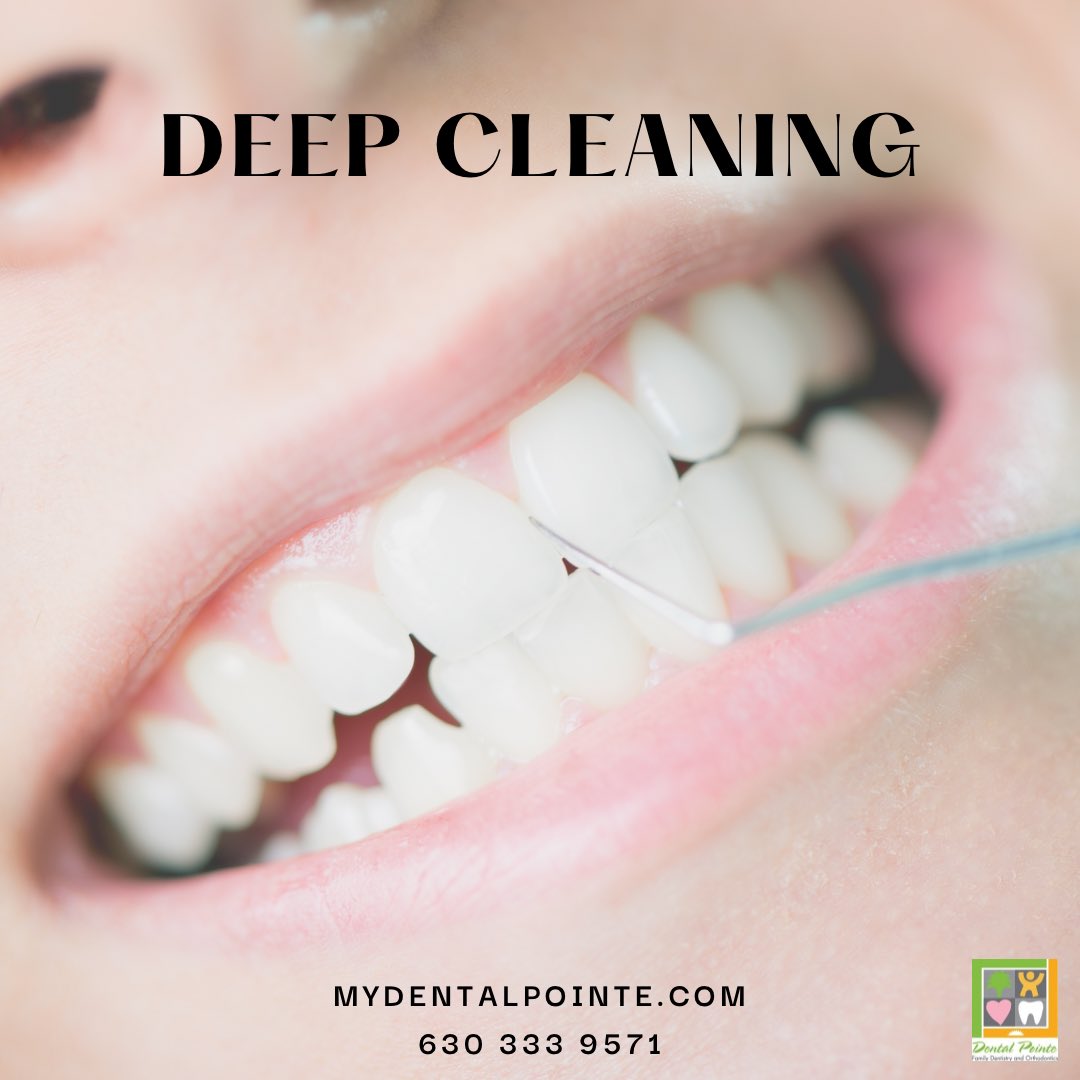 Your dentist may recommend a deep cleaning to remove the tartar from under the gums using special instruments. Leaving this untreated can cause gum disease and loose teeth.#dentalpointe #napervilledentist #auroradentist #warrenvilledentist #familydentist