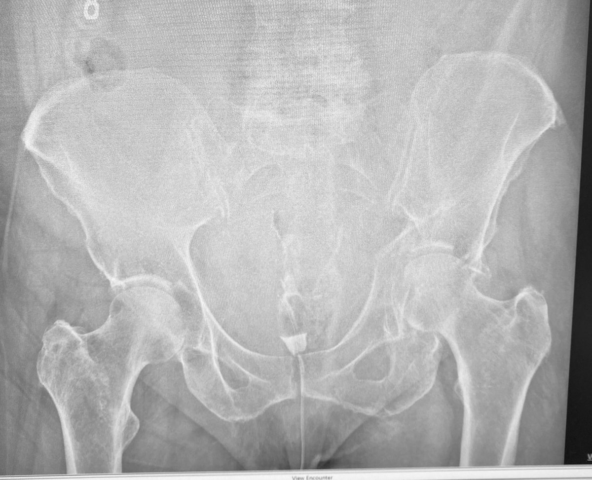 ML Chip Routt tweet media