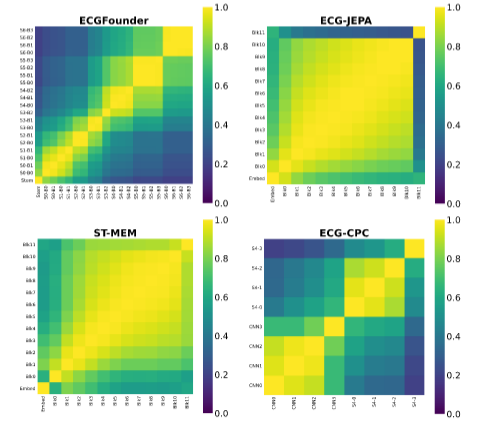 nstrodt's tweet photo. Representation Diversity: Models with similar accuracy learn distinct internal patterns, revealing multiple paths to effective ECG understanding. https://t.co/7qGn4dfxhi