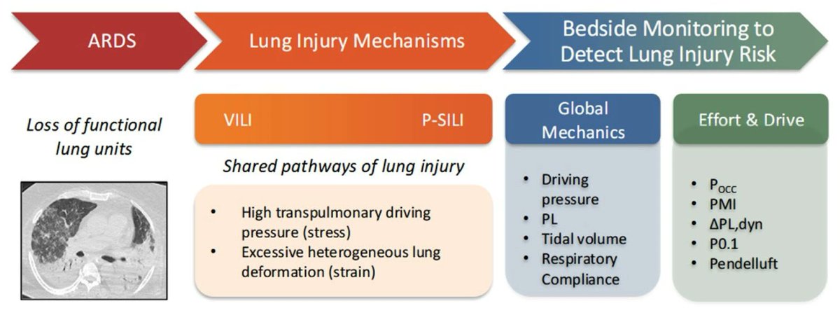 CritCareReviews's tweet photo. Protective Ventilation During Controlled and Partial Ventilatory Support in ARDS: Clinical–Physiological Background and Monitoring 

CCR Journal Watch 
https://t.co/Sp06oA6IDG https://t.co/2Ik59qFths