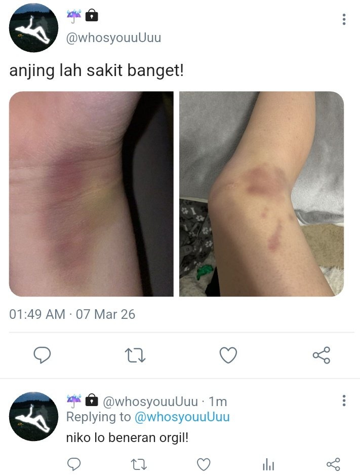 𐙚⋆°𝓑𝓾𝓫𝓫𝓵𝓮 🫧 tweet media