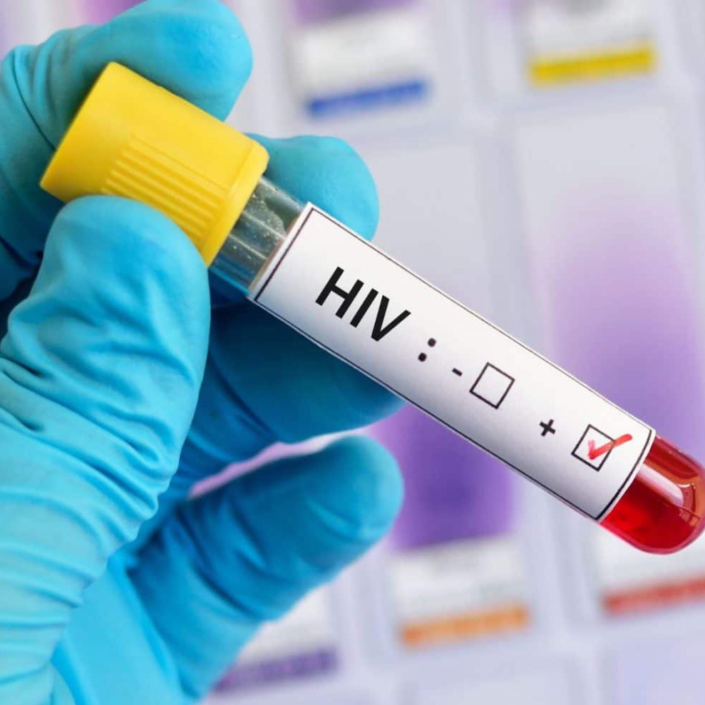 🚨CIÊNCIA: Cientistas conseguiram remover o DNA do HIV de células humanas em laboratório utilizando a técnica CRISPR, um avanço considerado promissor na busca por uma possível cura no futuro.