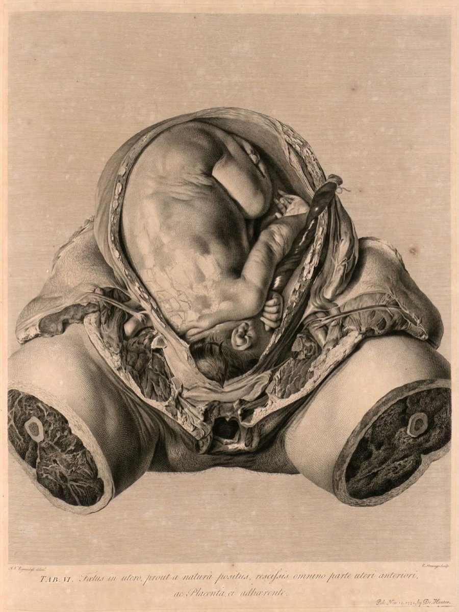 oscillate23's tweet photo. Anatomia uteri humani gravidi tabulis illustrata [The anatomy of the human gravid uterus exhibited in figures], ca. 1774, William Jan van Rymsdyk. https://t.co/KkhFUw6P4x