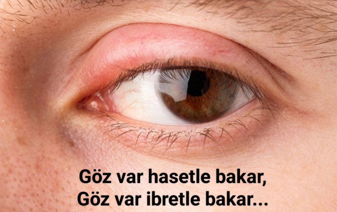 Bakış deyip geçme:

Göz var hasetle bakar, 
Göz var ibretle bakar...