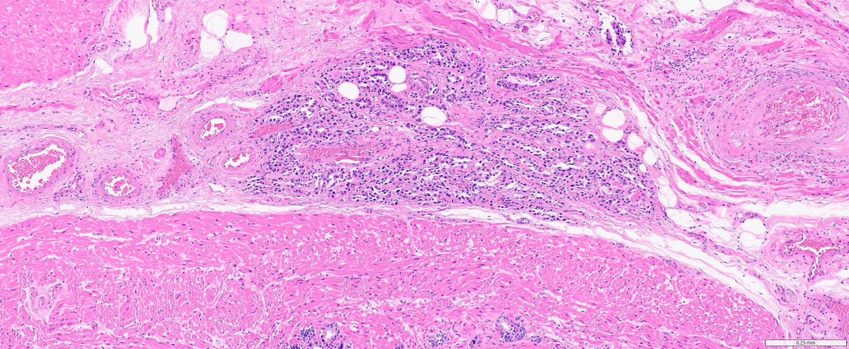 Ankur Sangoi tweet media