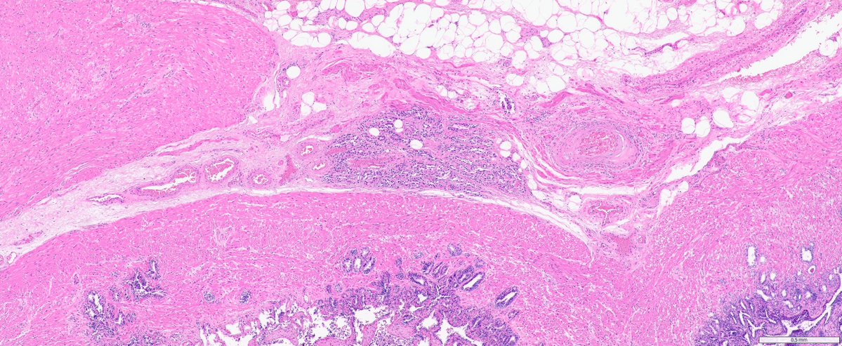 Ankur Sangoi tweet media